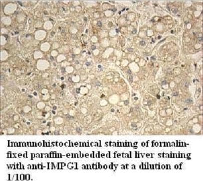 Polyclonal Rabbit anti-Human IMPG1 Antibody (aa217-437, IHC, WB)