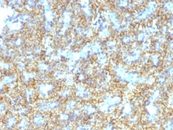 PTH / Parathyroid Hormone Antibody (C-Terminus, clone PTH/1174)