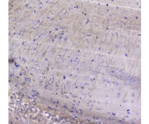 Polyclonal Rabbit anti-Rat BTC / Betacellulin Antibody (IHC, WB)
