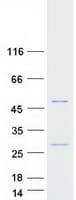 Human C1orf135 Protein (Recombinant Myc-DDK (Flag))