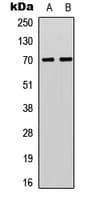 Polyclonal Rabbit anti-Human RPS6KB1 / P70S6K / S6K Antibody (phospho-Thr412, IHC, IF, WB)