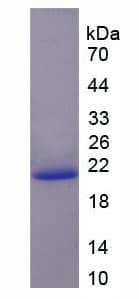 Rat PPIB / Cyclophilin B Protein (Recombinant His)