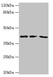 Polyclonal Rabbit anti-Human GRB4 / NCK2 Antibody (aa1-380, IHC, WB)
