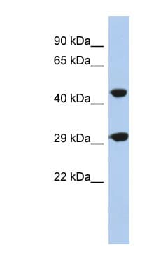 TANGO2 / C22orf25 Antibody (N-Terminus)