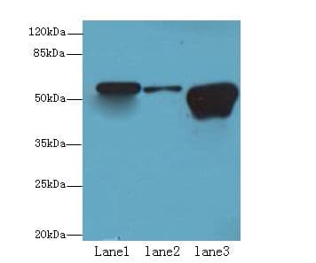 TBC1D22A Antibody