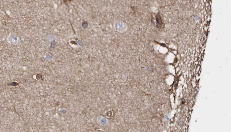 ABLIM1 Antibody