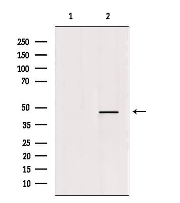Polyclonal Rabbit anti-Human LMX1B Antibody (IF, WB)