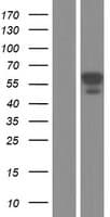 CAMKK2 Protein (Over-Expression Lysate Myc-DDK (Flag))