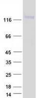 Human LNPEP Protein (Recombinant Myc-DDK (Flag))