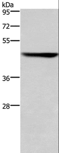 KRT16 / CK16 / Cytokeratin 16 Antibody