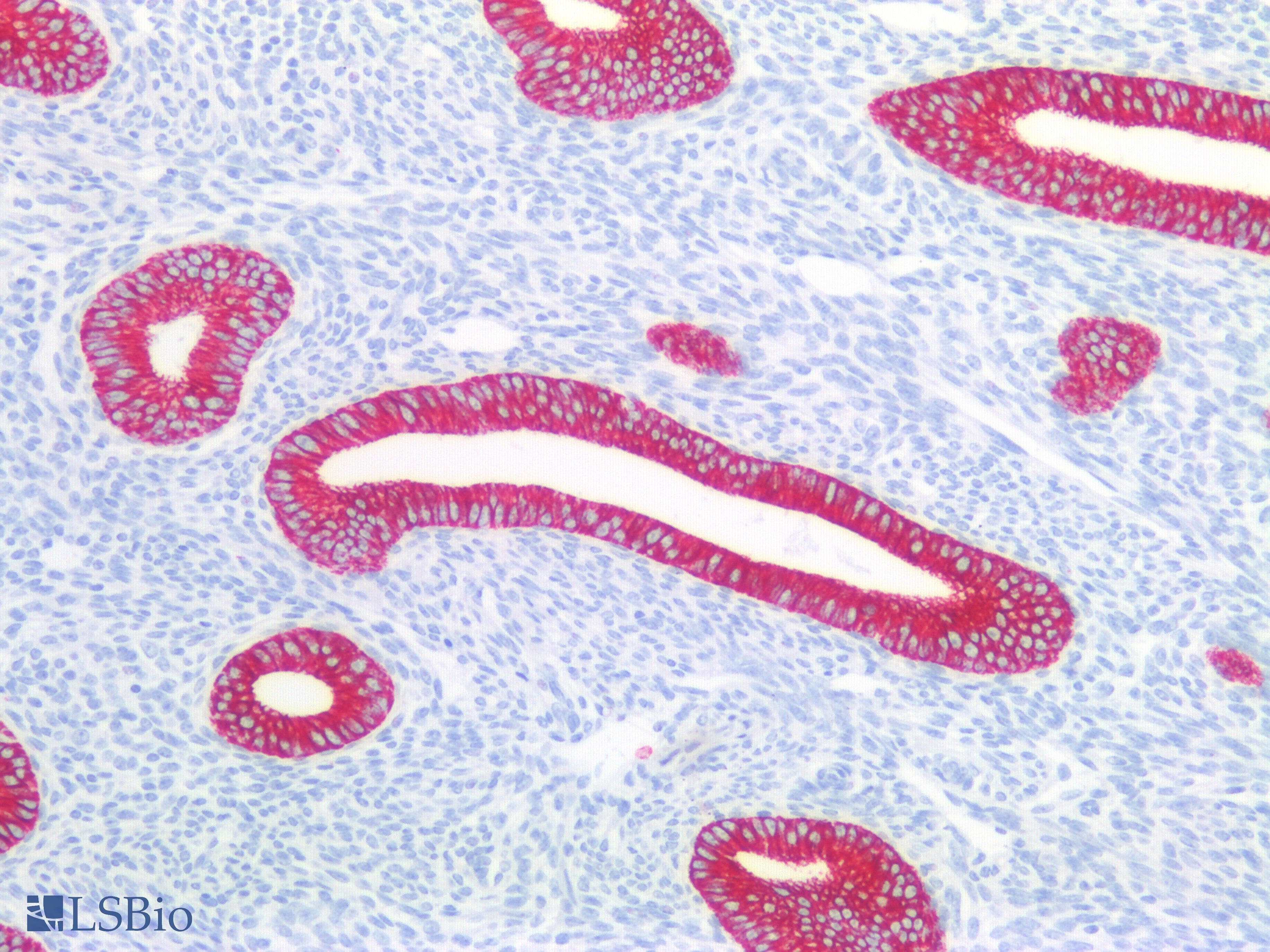 PathPlus™ Polyclonal Rabbit anti-Human KRT8 / CK8 / Cytokeratin 8 Antibody (C-Terminus, IHC, IF, WB)