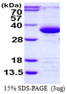 Human PSME3 Protein (Recombinant His)