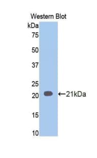 IVL / Involucrin Antibody (aa6-156)