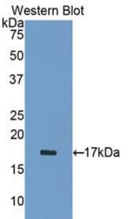 ADAMTS1 Antibody (aa476-614)