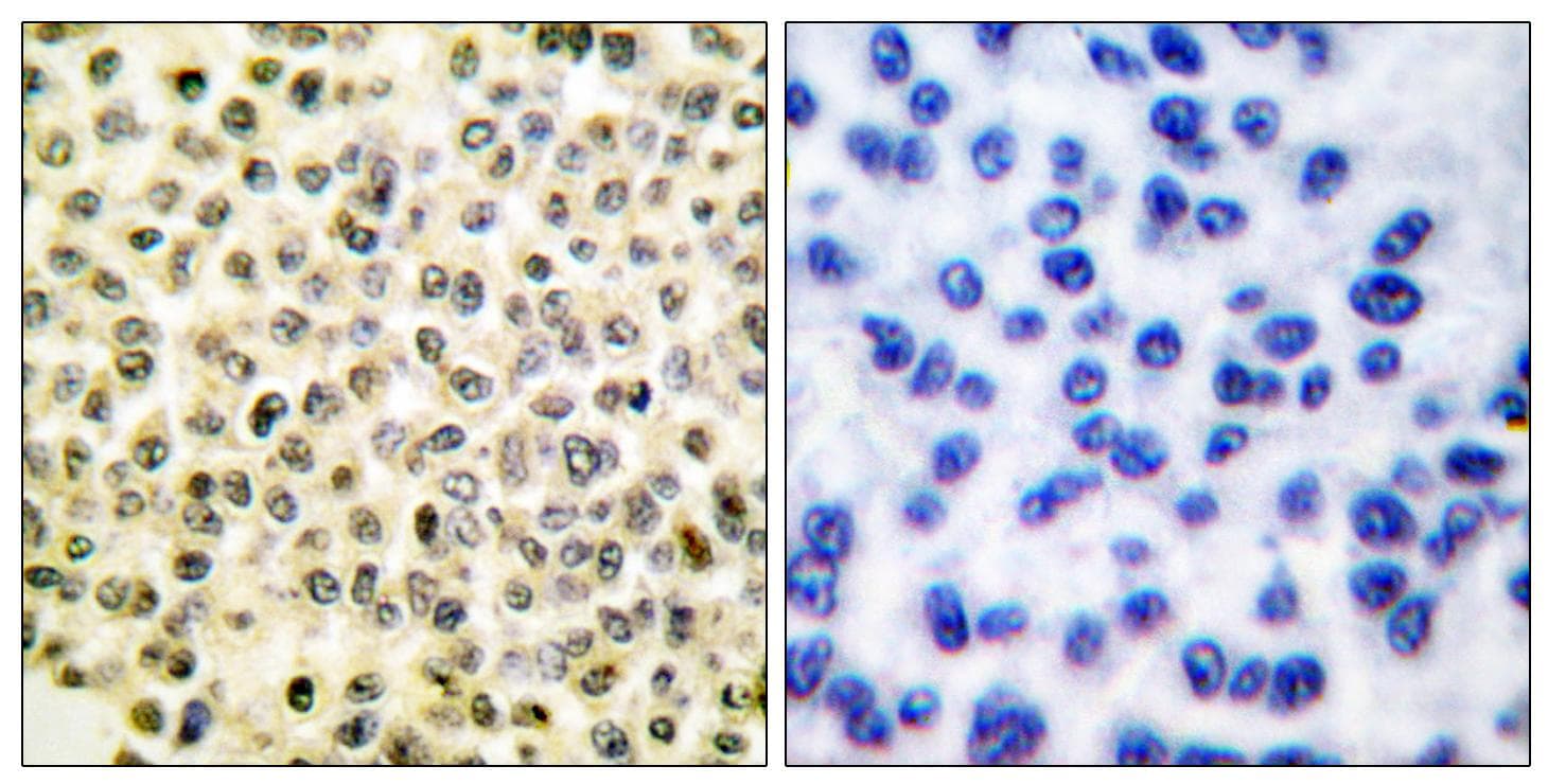 SMAD1 Antibody (phospho-Ser465)