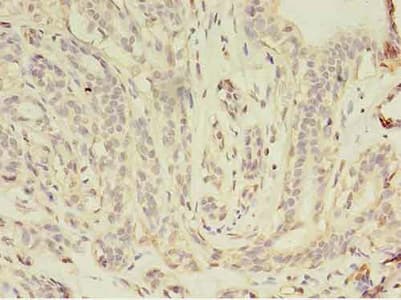 Polyclonal Rabbit anti-Human JUP/CTNNG/Junction Plakoglobin Antibody (IHC, WB)