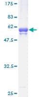 Human TSSK3 / STK22C Protein (Recombinant GST)