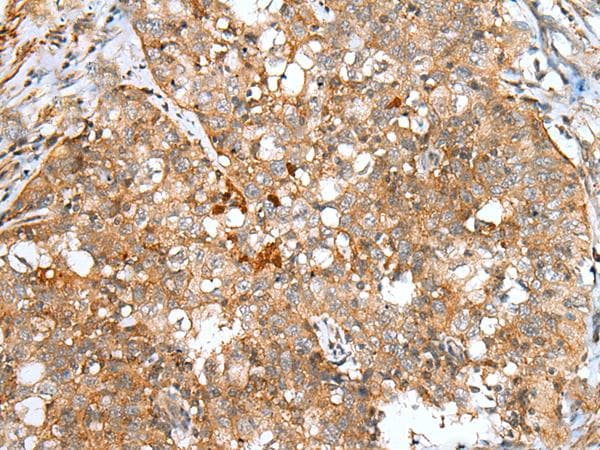 DCX / Doublecortin Antibody