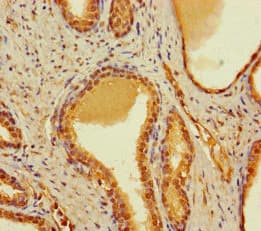 Polyclonal Rabbit anti-Human CBWD2 Antibody