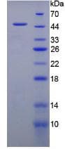 Human EMA / MUC1 Protein (Recombinant His-GST, N-terminus)