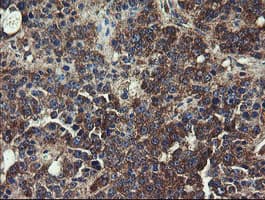 UBE2J1 Antibody (clone OTI1F6)