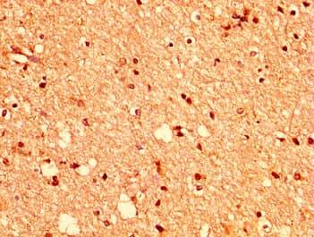 EPHA2 / EPH Receptor A2 Antibody