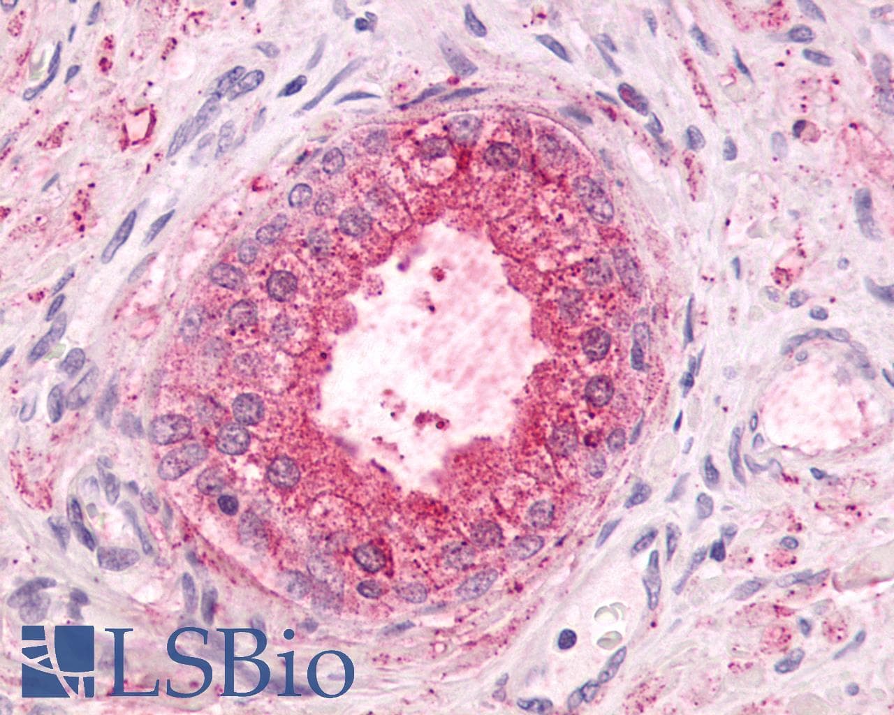 PathPlus™ Polyclonal Rabbit anti-Human GPR55 Antibody (Extracellular Domain, IHC)