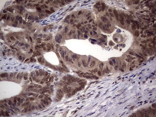 Monoclonal Mouse anti-Human C14orf166 Antibody (clone OTI2C3, IHC, WB)