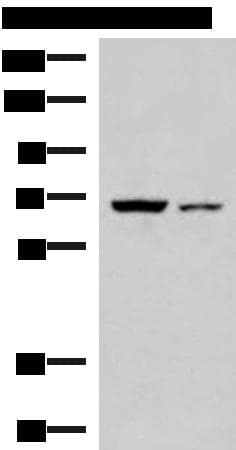 EWSR1 / EWS Antibody