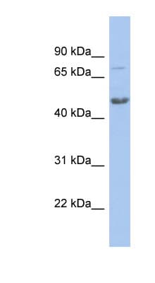 CBX8 Antibody (aa71-120)