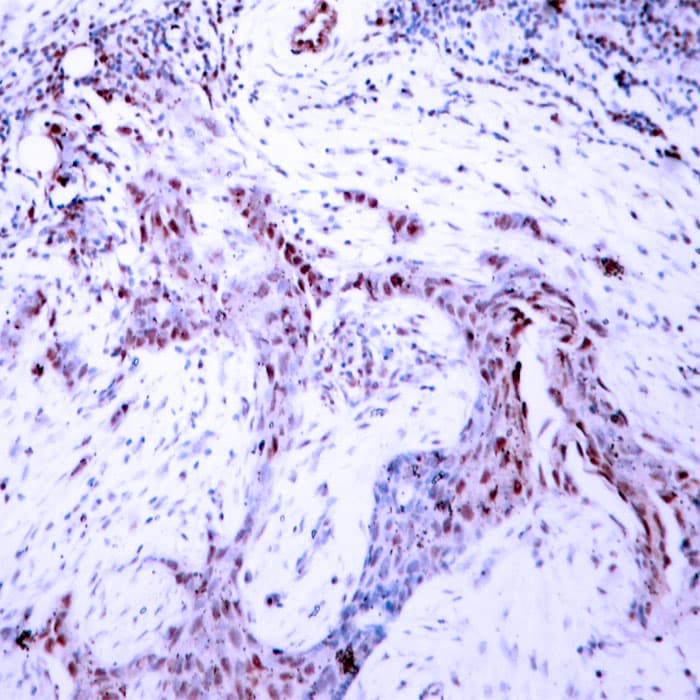 PR / Progesterone Receptor Antibody (phospho-Ser190)