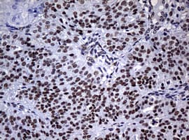 Monoclonal Mouse anti-Human NBN / Nibrin Antibody (clone OTI2G4, IHC, WB)