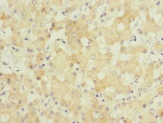 Polyclonal Rabbit anti-Human GATC Antibody (IHC)