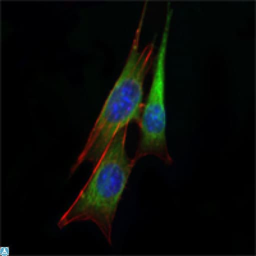 ETS1 / ETS-1 Antibody