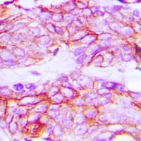 Polyclonal Rabbit anti-Human KDR / VEGFR2 / FLK1 Antibody (C-Terminus, IHC, IF, WB)