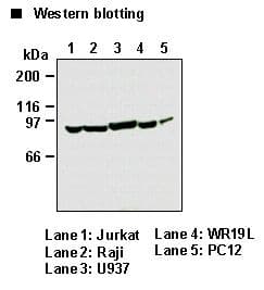 PIK3R1 / p85 Alpha Antibody (clone AB6)