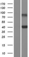 CLEC10A / CD301 Protein (Over-Expression Lysate Myc-DDK (Flag))