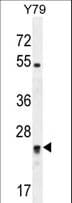 DPCD Antibody (aa96-136)