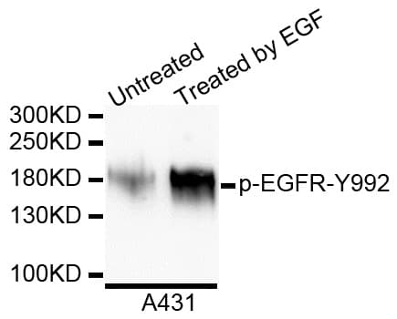 EGFR Antibody (phospho-Tyr1016)