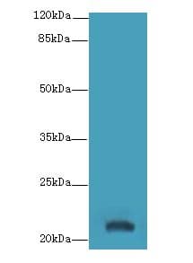 YKT6 Antibody