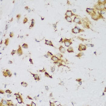 MTDH / Metadherin Antibody