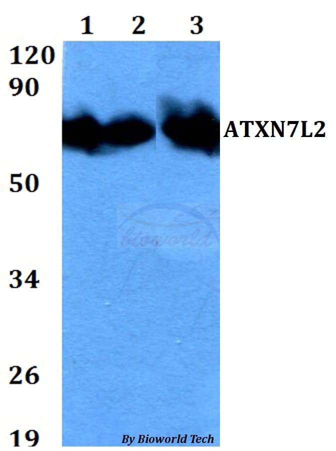 Polyclonal Rabbit anti-Human ATXN7L2 Antibody (WB)