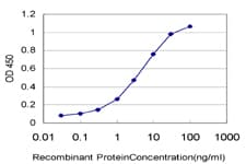 IHC-plus™ STAT6 Antibody (clone 6C10)