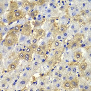 DSP / Desmoplakin Antibody