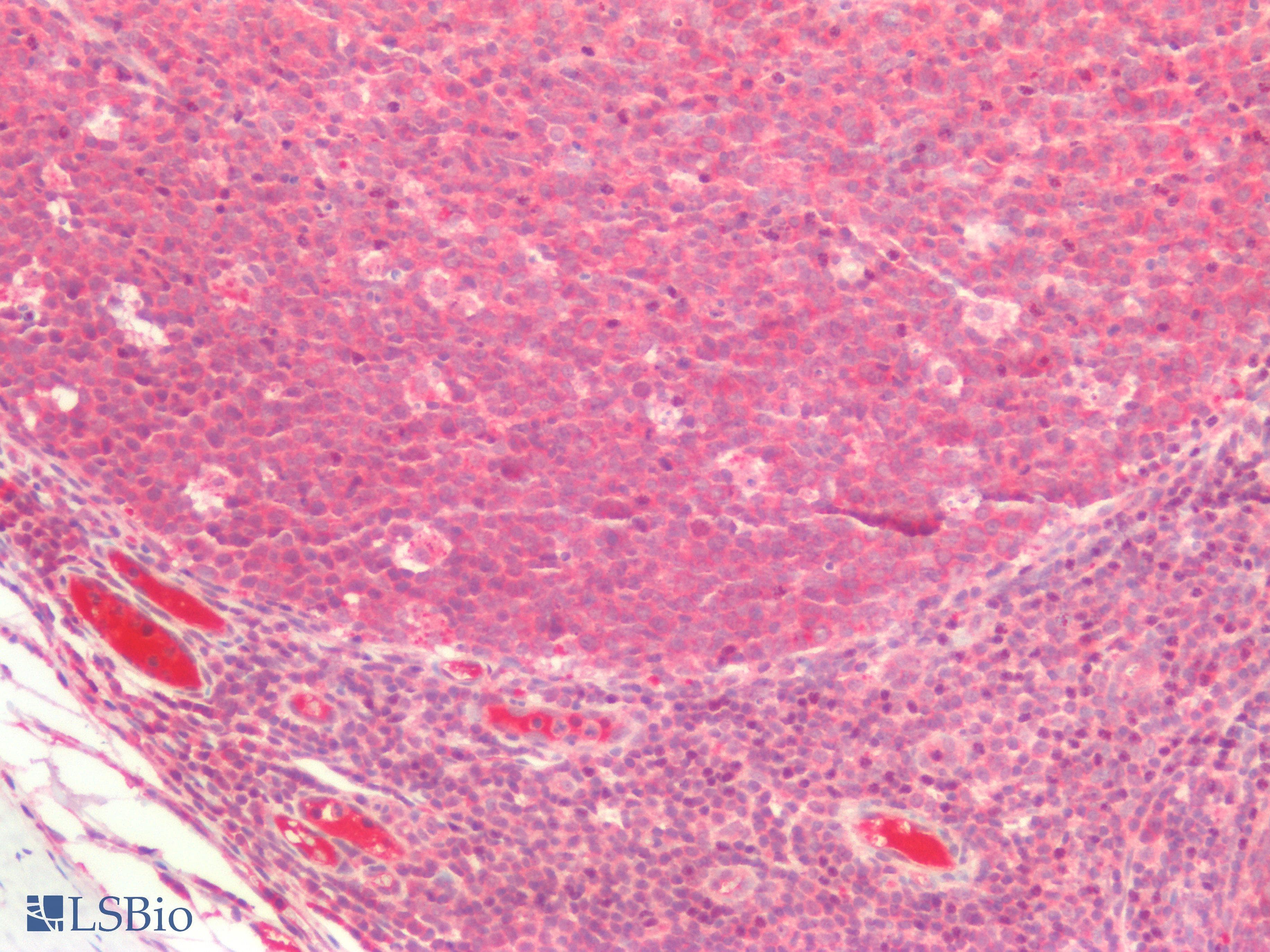 PathPlus™ Polyclonal Rabbit anti-Human RASSF1 / RASSF1A Antibody (IHC, IF, WB)