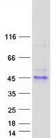 Human TMIGD1 Protein (Recombinant Myc-DDK (Flag))