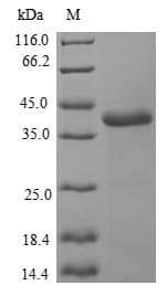 Human NCALD / Neurocalcin Delta Protein (Recombinant GST, N-terminus)