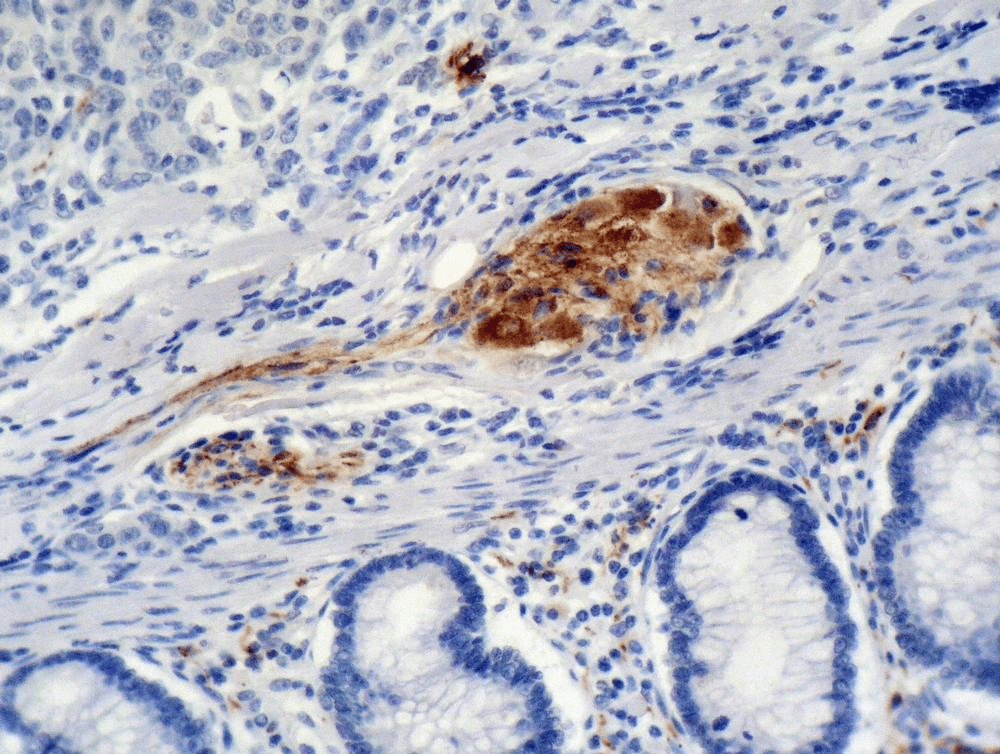 CDKN1A / WAF1 / p21 Antibody (clone WA-1)