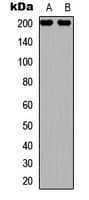 IHC-plus™ Polyclonal Rabbit anti-Human TUBGCP6 / GCP6 Antibody (aa756-795, IHC, WB)