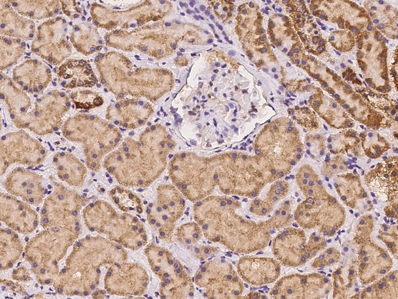 LEKR1 Antibody